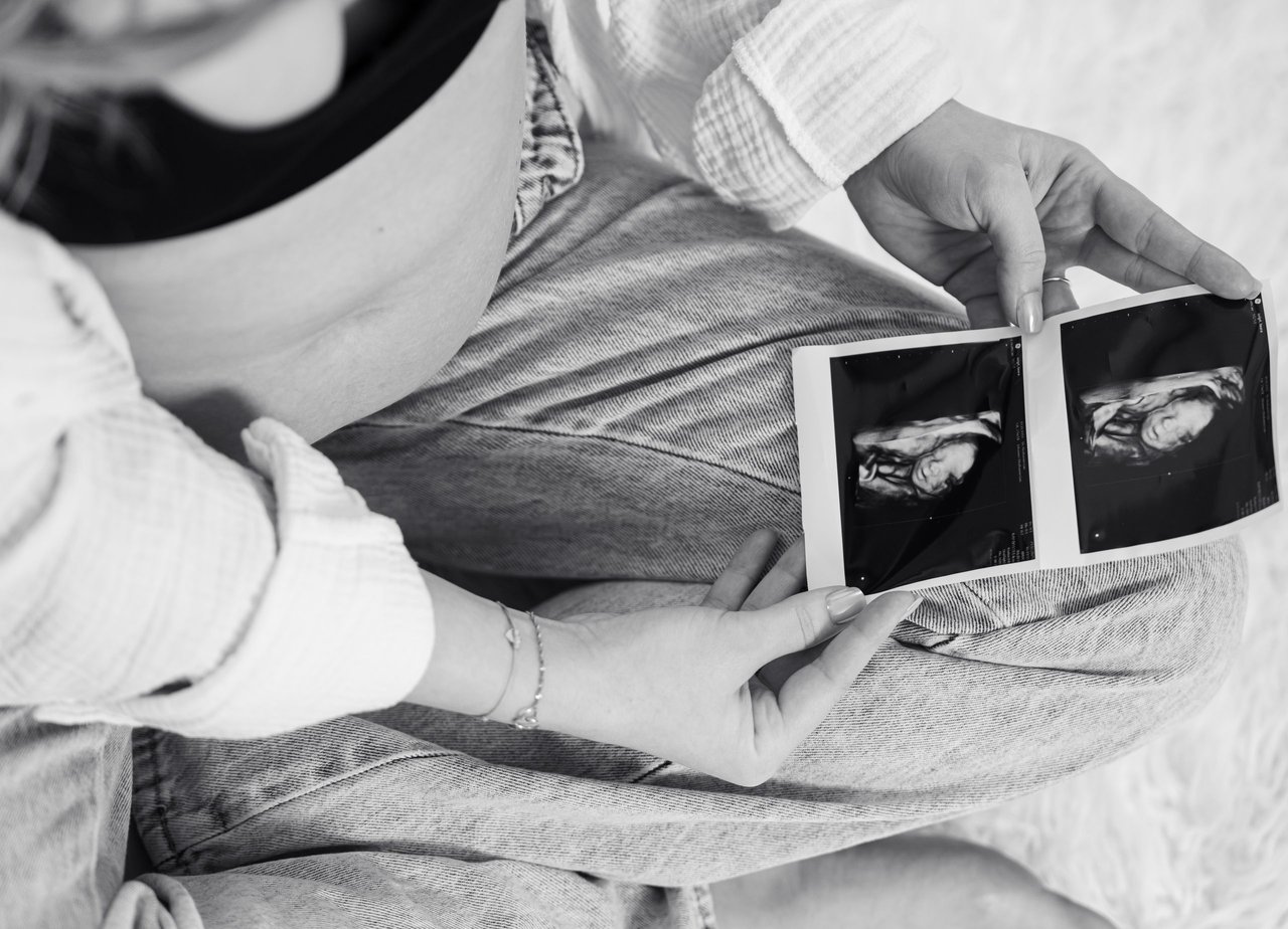 Babybauch-Shooting: S/w Babybauch mit Ultraschallbildern, Flatlay – Photography Ruel, Ebreichsdorf